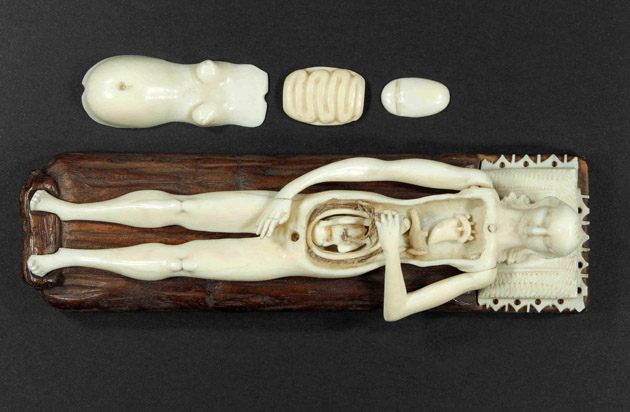 Anatómiai női test modell, Semmelweis Orvostörténeti Múzeum