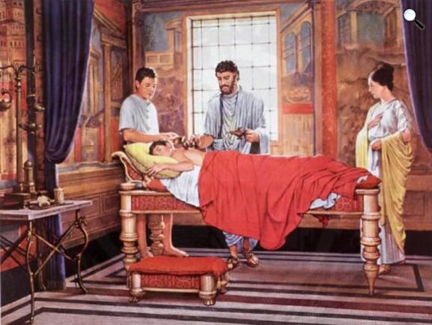 Köpölyözés terápia az ókori Rómában (Fotó: Wikimédia)